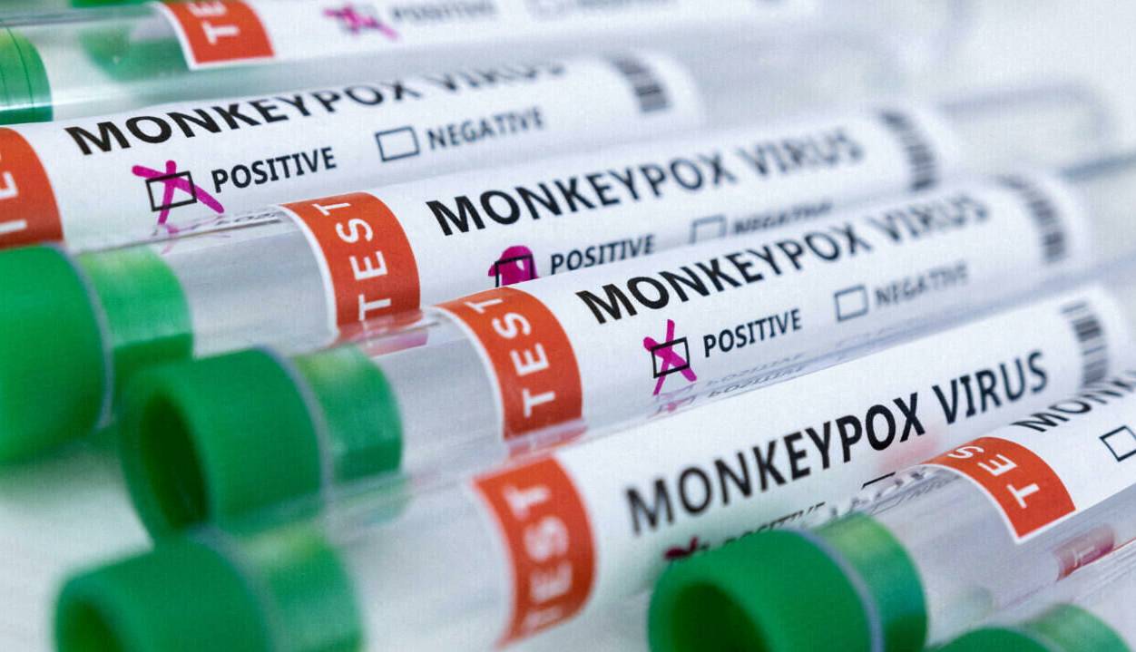 تعداد مبتلایان به ویروس آبله میمون در سنگاپور به ۱۶ نفر رسید